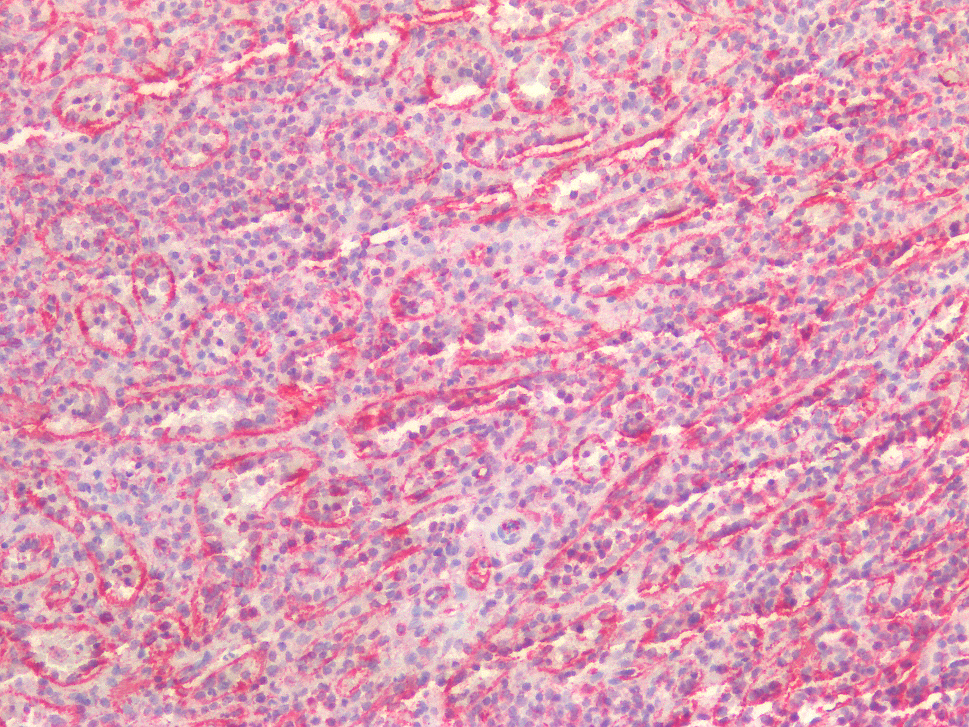Figure 9. Immunostaining of human paraffin embedded tissue sections of human spleen with MUB1904P (diluted 1:200), showing the specific pattern of vimentin in the mesenchymal cell types.